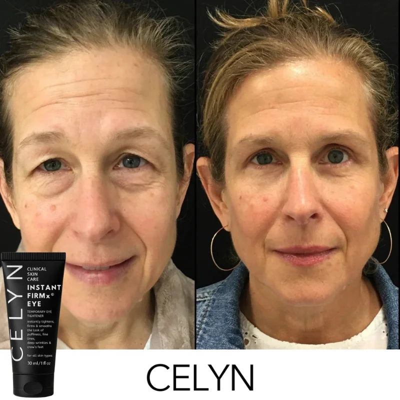 Instant Firmex Eye Tightener