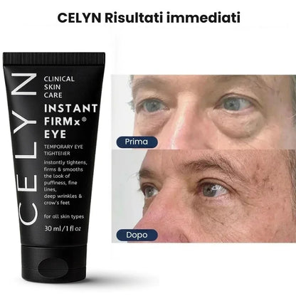 Instant Firmex Eye Tightener